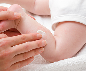 Application of soothing anti-inflammatory cream on skin to reduce redness and irritation